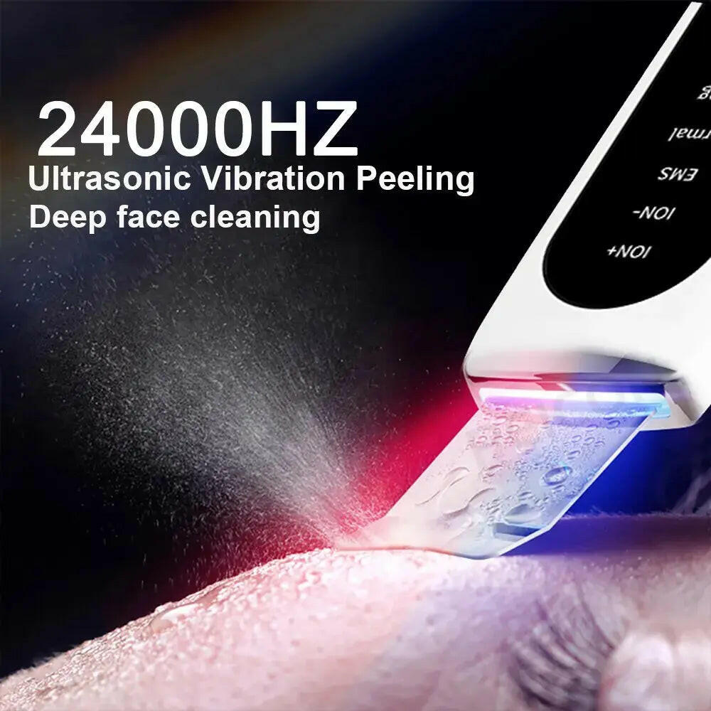 Ultrasonic Skin Scrubber and Blackhead Remover for Deep Facial Cleaning - RtrStore